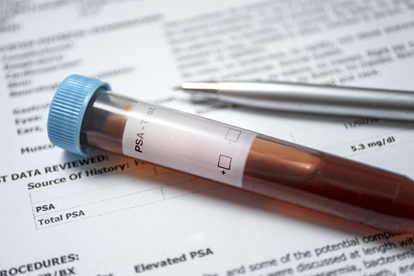 close-up photo of a vial of blood marked PSA test alongside a pen; both are resting on a document showing the test results